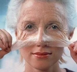 استعادة الجلد على الوجه مع الليزر